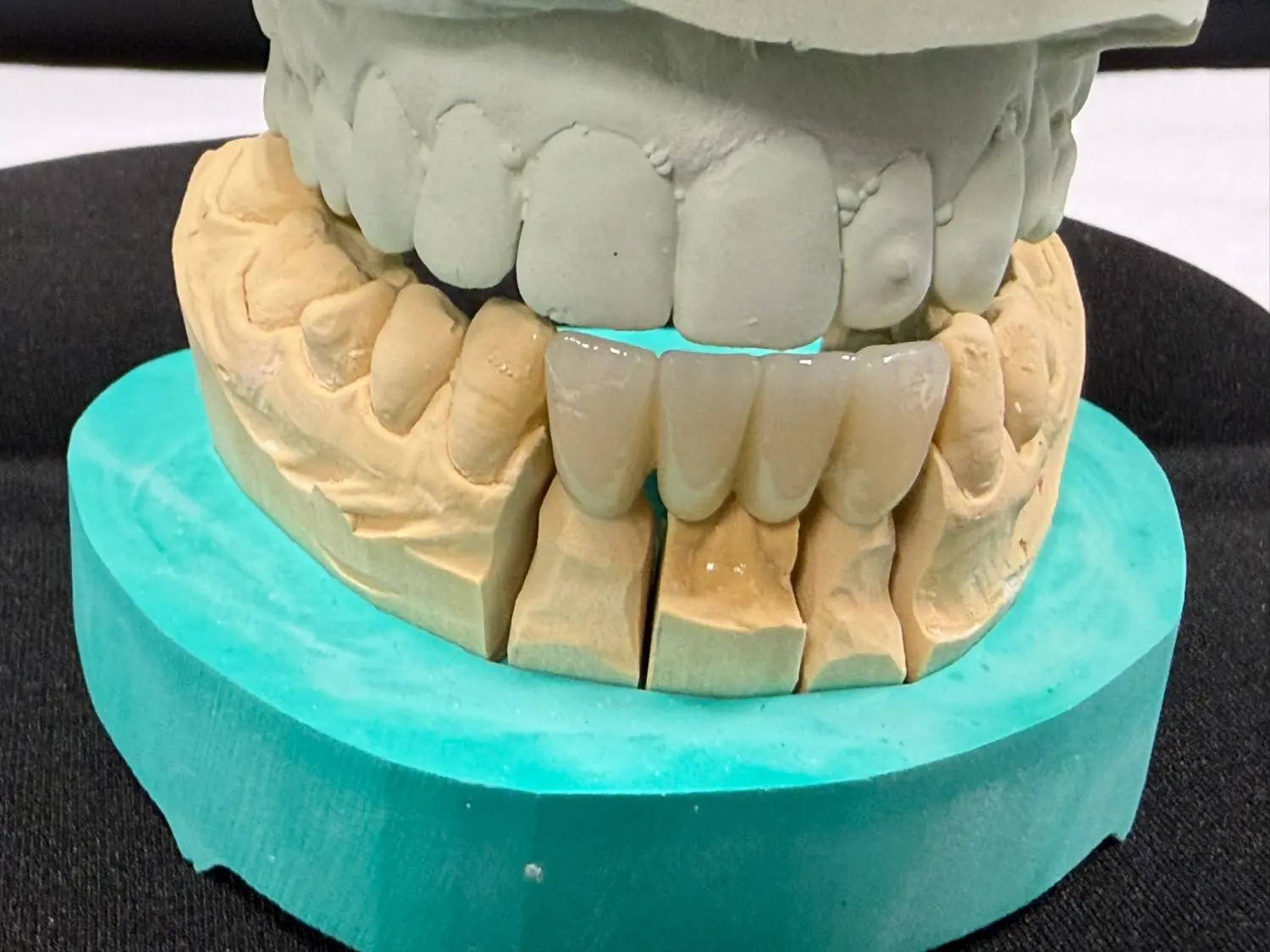 Kruse & Mordhorst Zahntechnik GmbH - Das Bild zeigt eine Zahnbrücke aus Zirkonkeramik, die üblicherweise bei Restaurationen im Dentallabor verwendet wird.