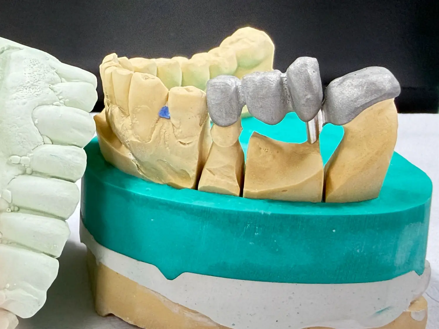Kruse & Mordhorst Zahntechnik GmbH - Das Bild zeigt eine Zahnbrücke aus Zirkonkeramik, die üblicherweise bei Restaurationen im Dentallabor verwendet wird.