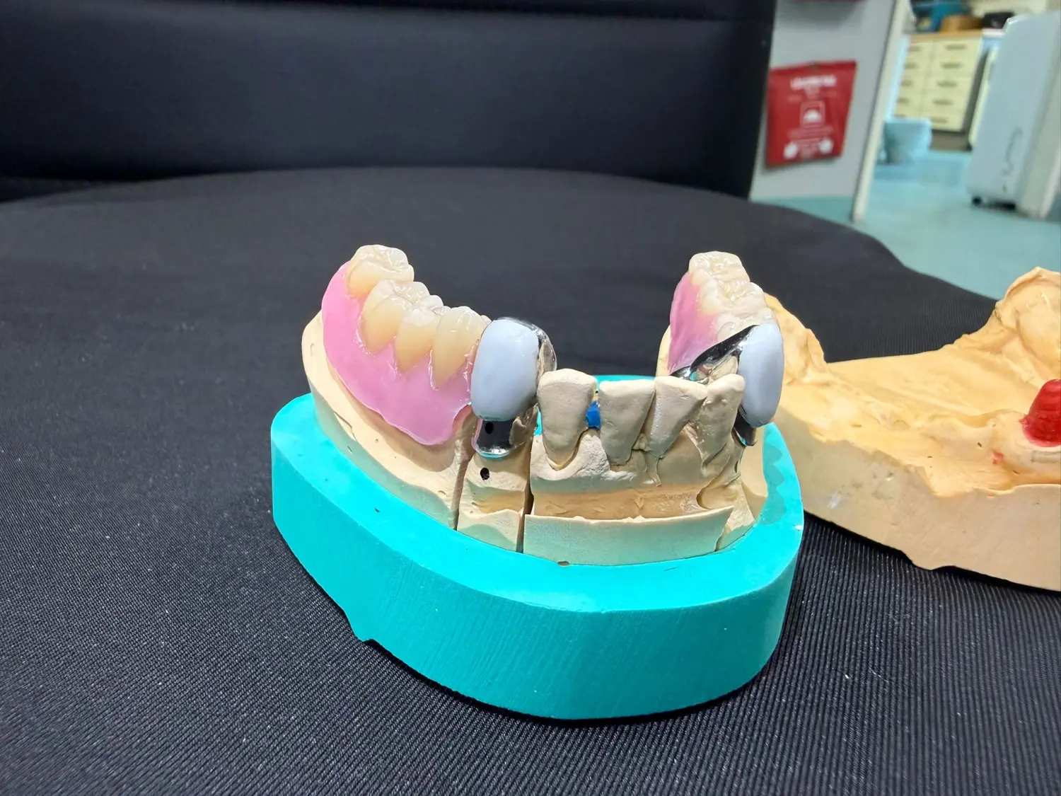 Kruse & Mordhorst Zahntechnik GmbH - Das Bild zeigt eine Zahnbrücke aus Zirkonkeramik, die üblicherweise bei Restaurationen im Dentallabor verwendet wird.