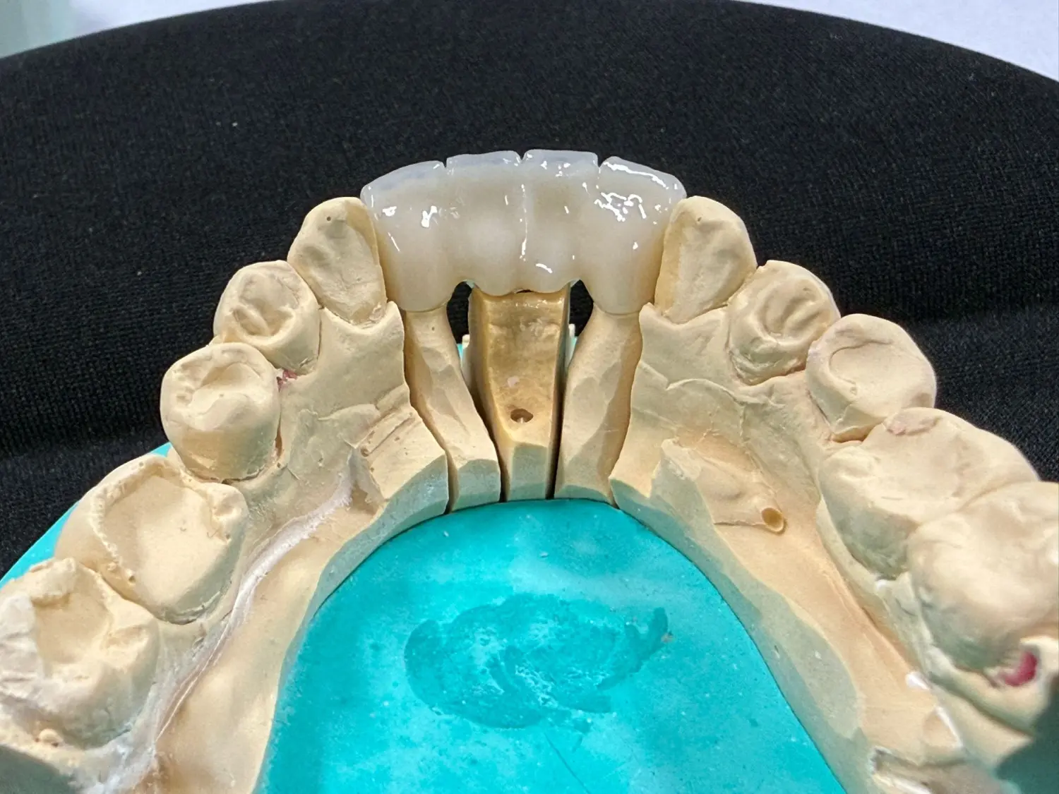 Kruse & Mordhorst Zahntechnik GmbH - Das Bild zeigt eine Zahnbrücke aus Zirkonkeramik, die üblicherweise bei Restaurationen im Dentallabor verwendet wird.