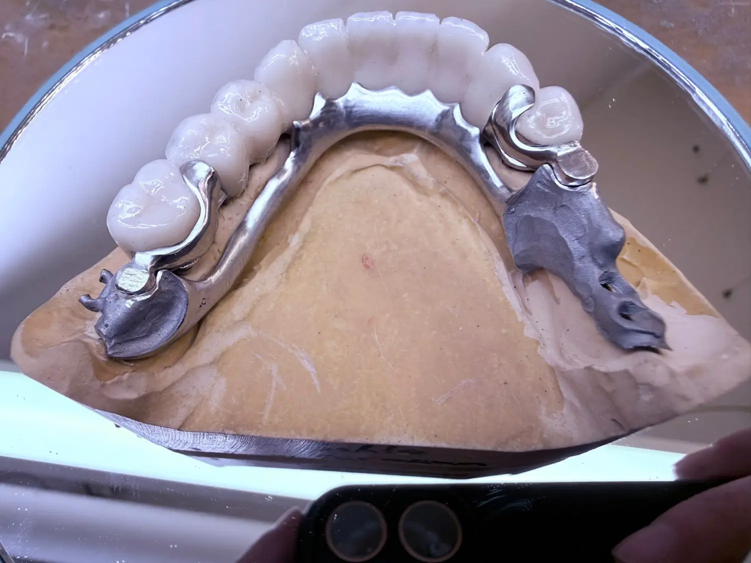 Kruse & Mordhorst Zahntechnik GmbH - Das Bild zeigt eine Zahnbrücke aus Zirkonkeramik, die üblicherweise bei Restaurationen im Dentallabor verwendet wird.