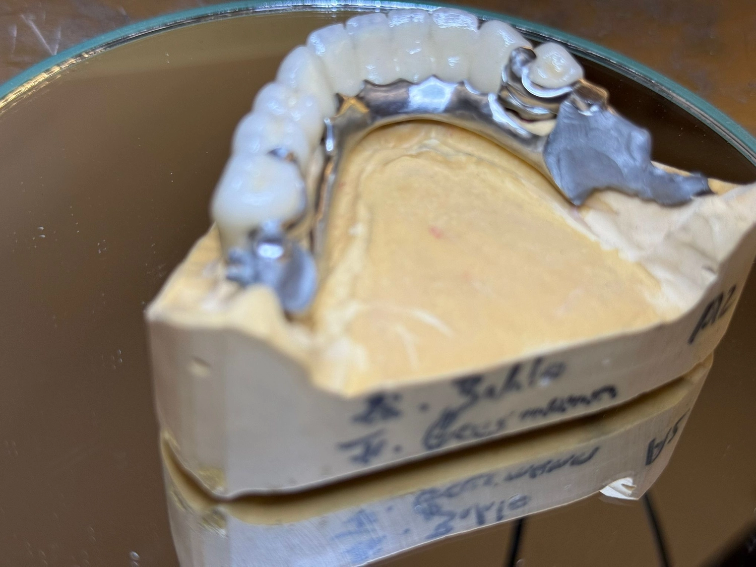 Kruse & Mordhorst Zahntechnik GmbH - Modellguß