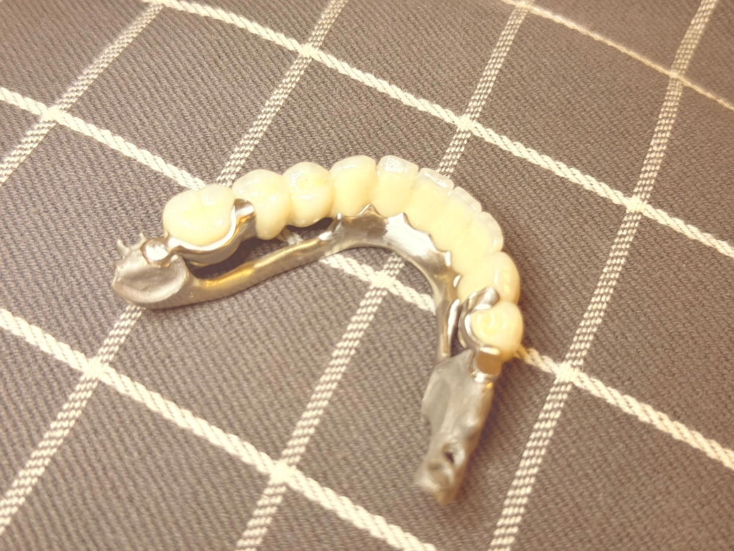 Kruse & Mordhorst Zahntechnik GmbH - Modellguß