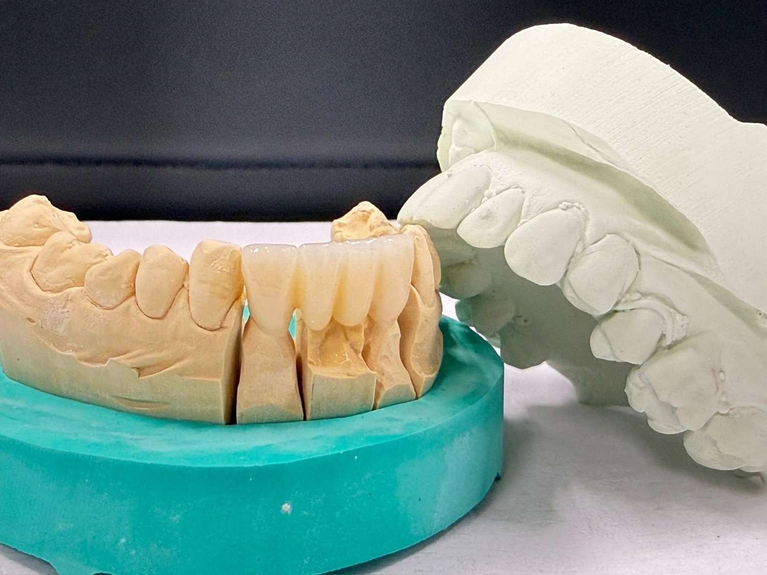 Kruse & Mordhorst Zahntechnik GmbH - Kronen & Brücken