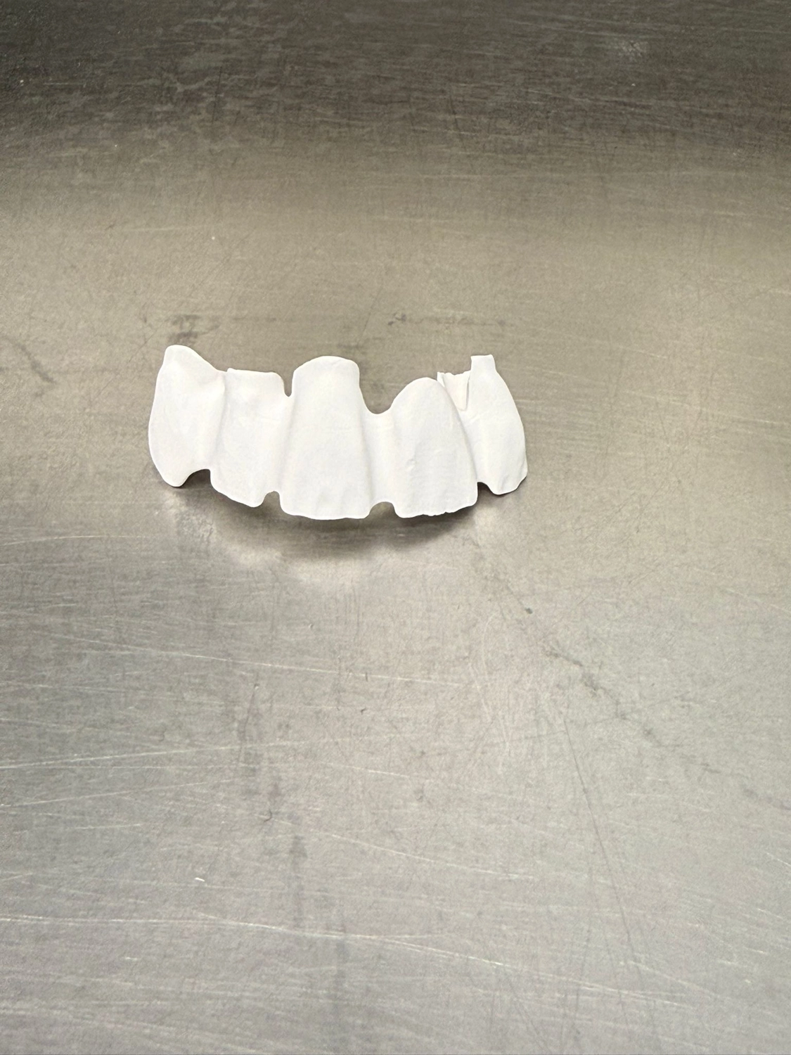 Kruse & Mordhorst Zahntechnik GmbH - Das Bild zeigt eine Zahnbrücke aus Zirkonkeramik, die üblicherweise bei Restaurationen im Dentallabor verwendet wird.