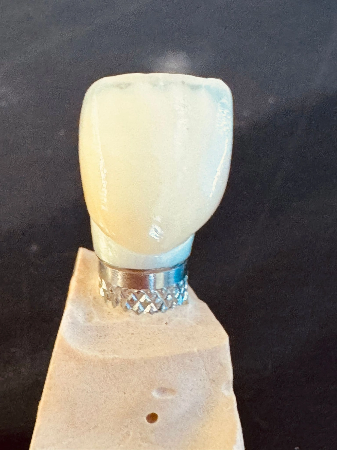 Kruse & Mordhorst Zahntechnik GmbH - Implantate & Prothetik