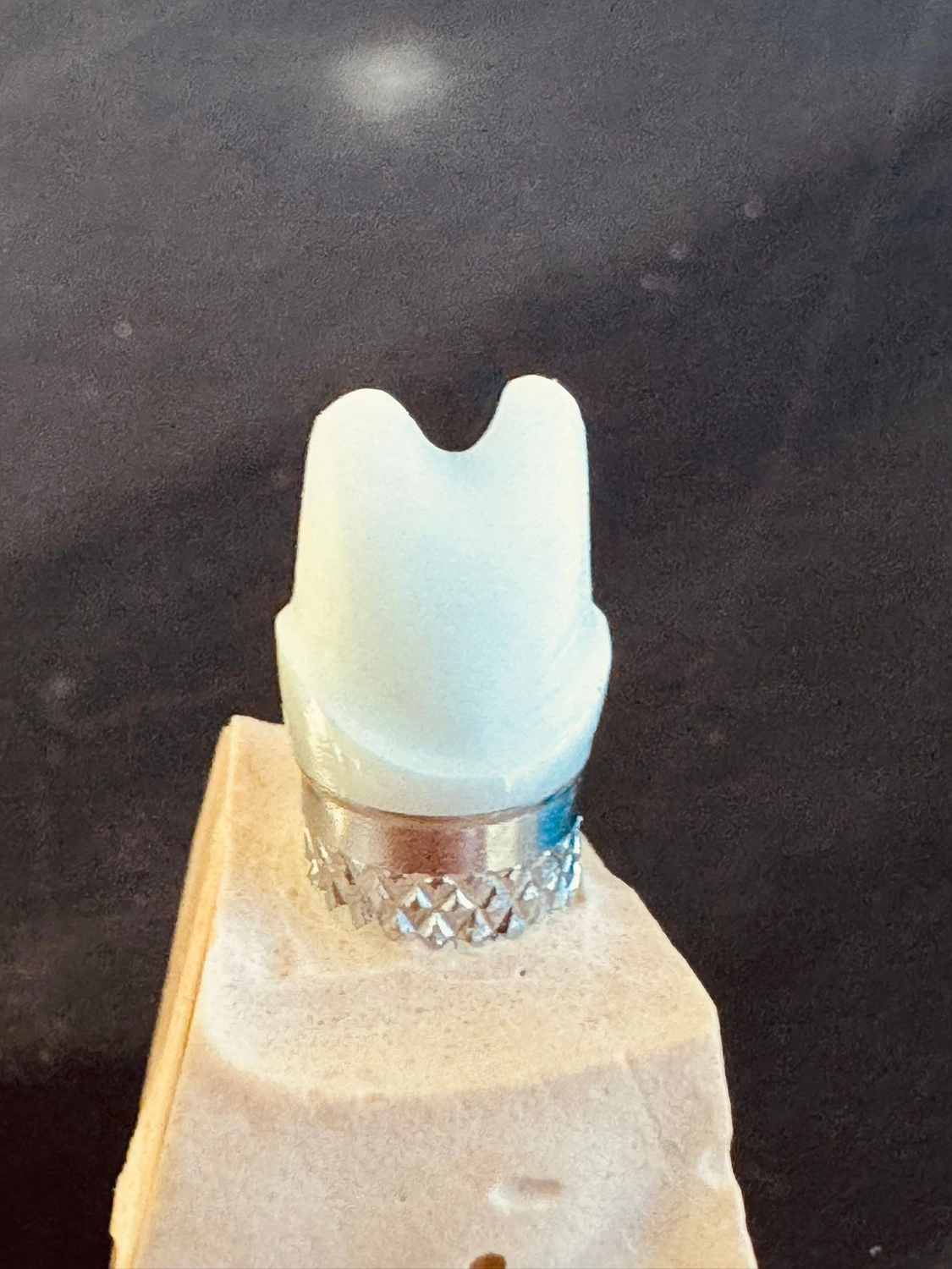 Kruse & Mordhorst Zahntechnik GmbH - Implantate & Prothetik