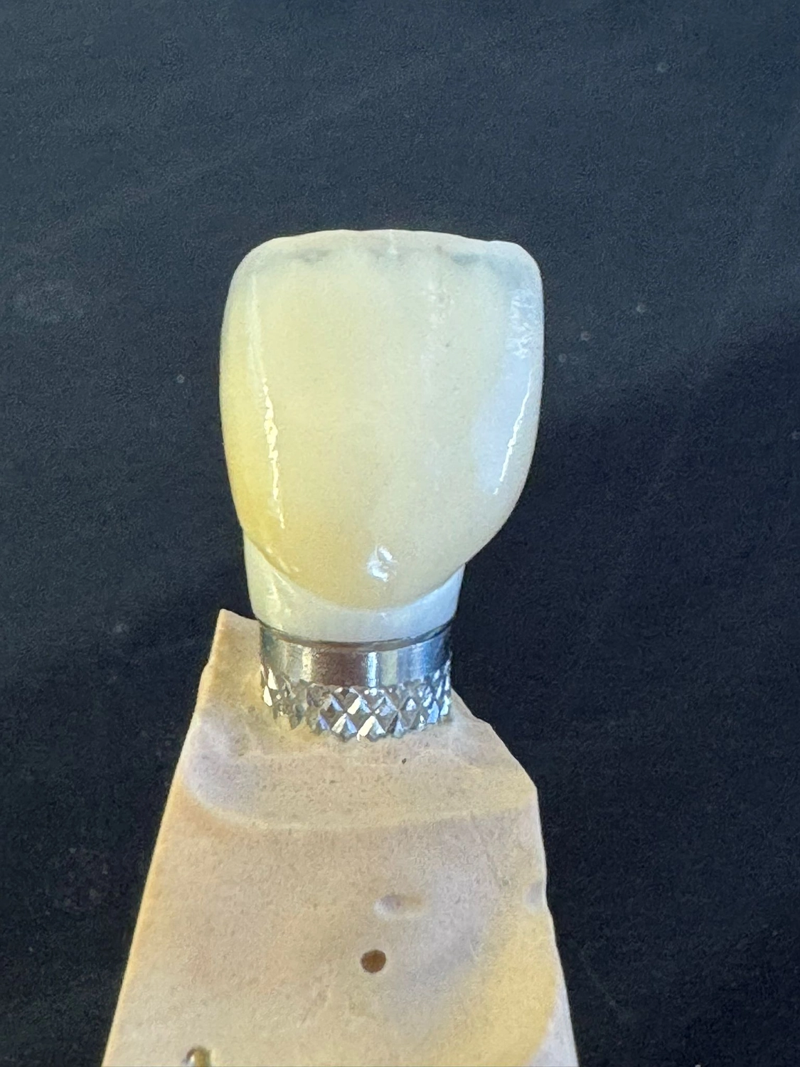 Kruse & Mordhorst Zahntechnik GmbH - Implantate & Prothetik