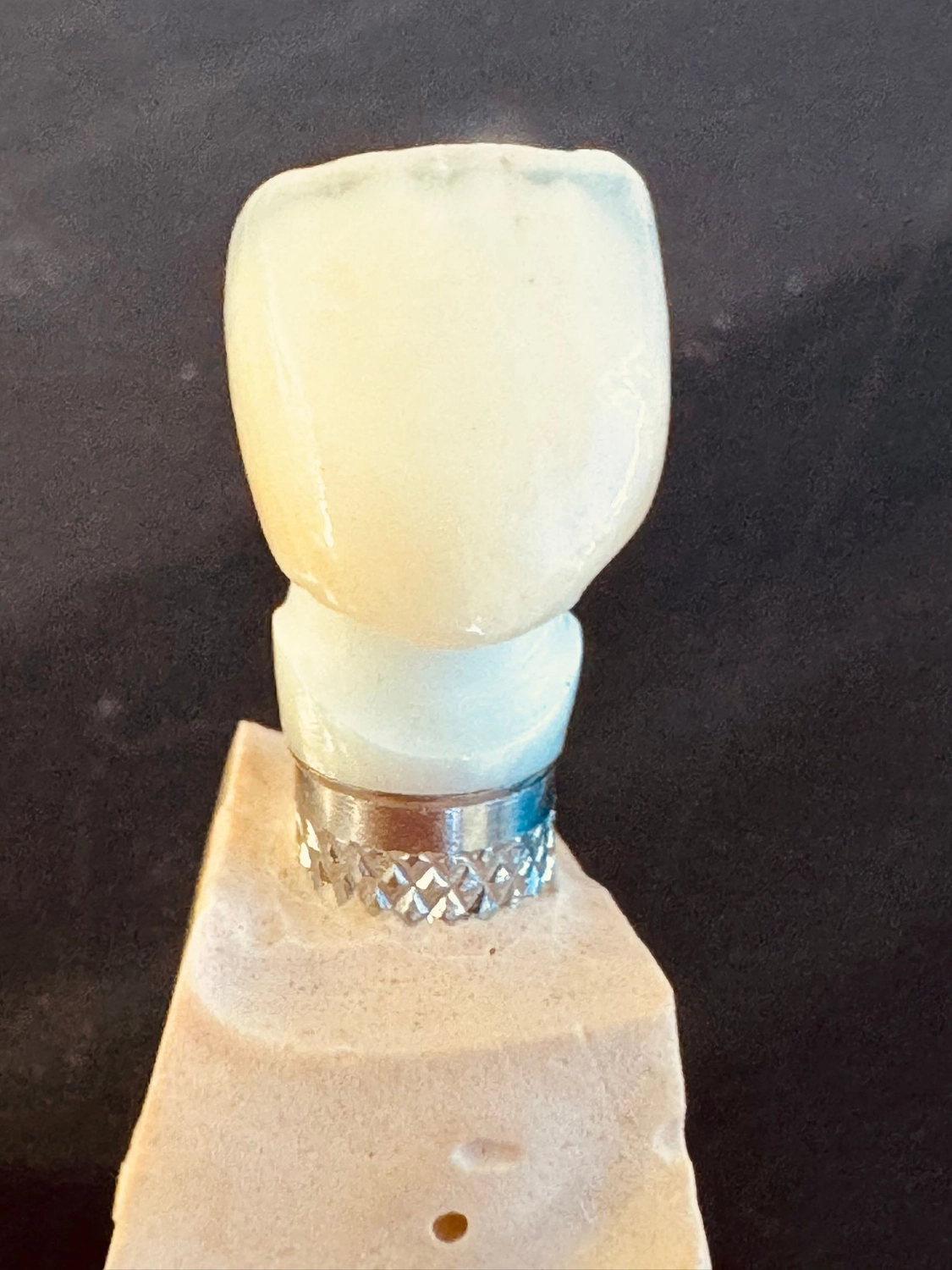 Kruse & Mordhorst Zahntechnik GmbH - Implantate & Prothetik