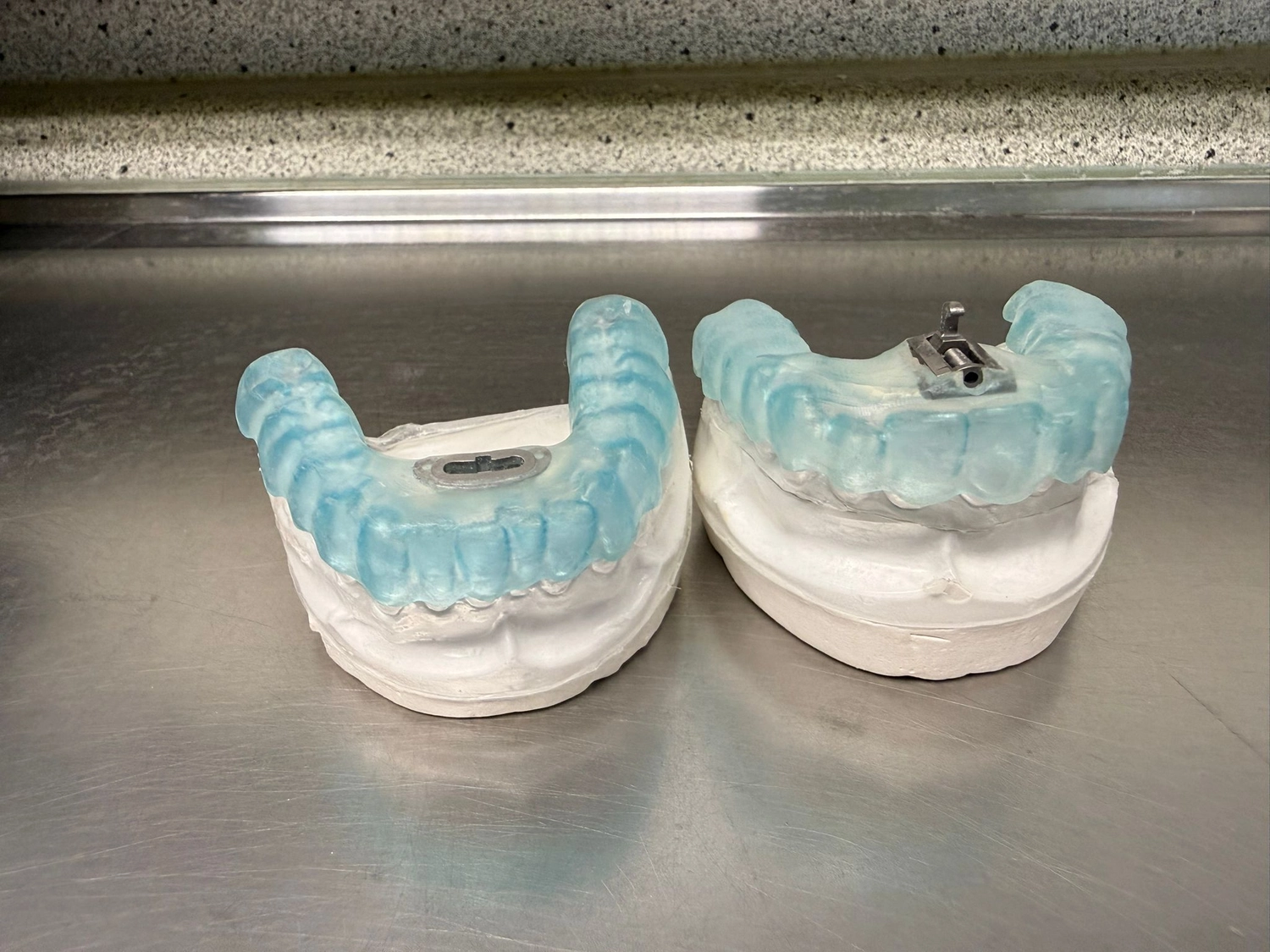 Kruse & Mordhorst Zahntechnik GmbH - Reparatur & Erweiterung/Service