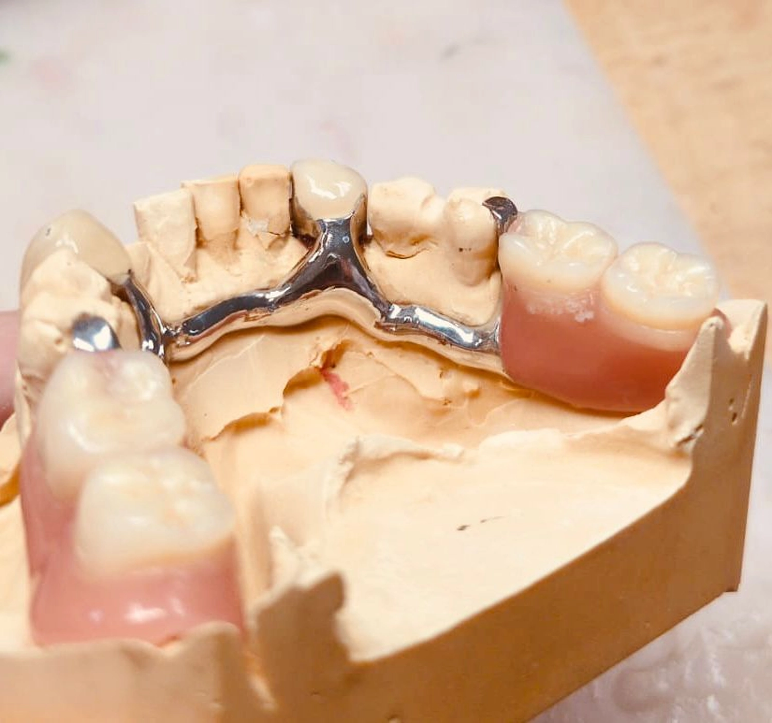 Kruse & Mordhorst Zahntechnik GmbH - Reparatur & Erweiterung/Service