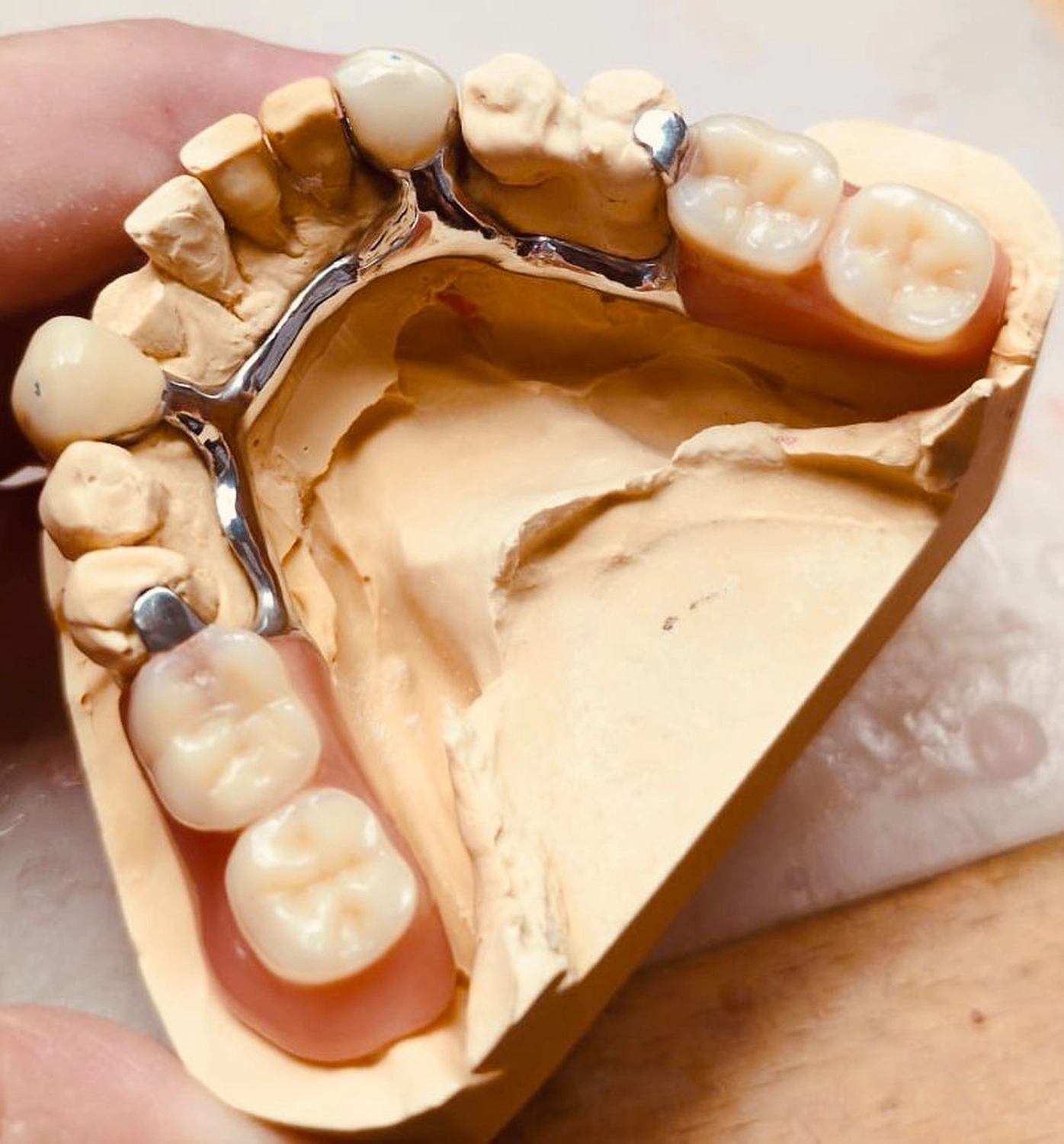 Kruse & Mordhorst Zahntechnik GmbH -Partielle & Totalprothesen