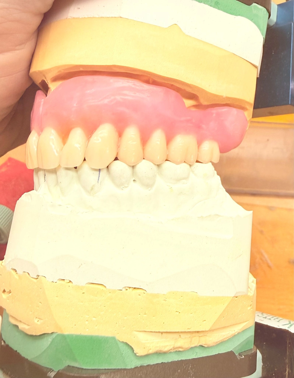 Kruse & Mordhorst Zahntechnik GmbH - Kronen & Brücken