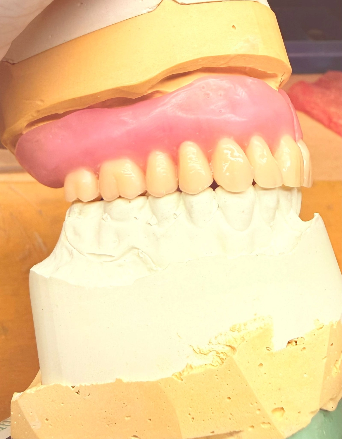 Kruse & Mordhorst Zahntechnik GmbH - Kronen & Brücken