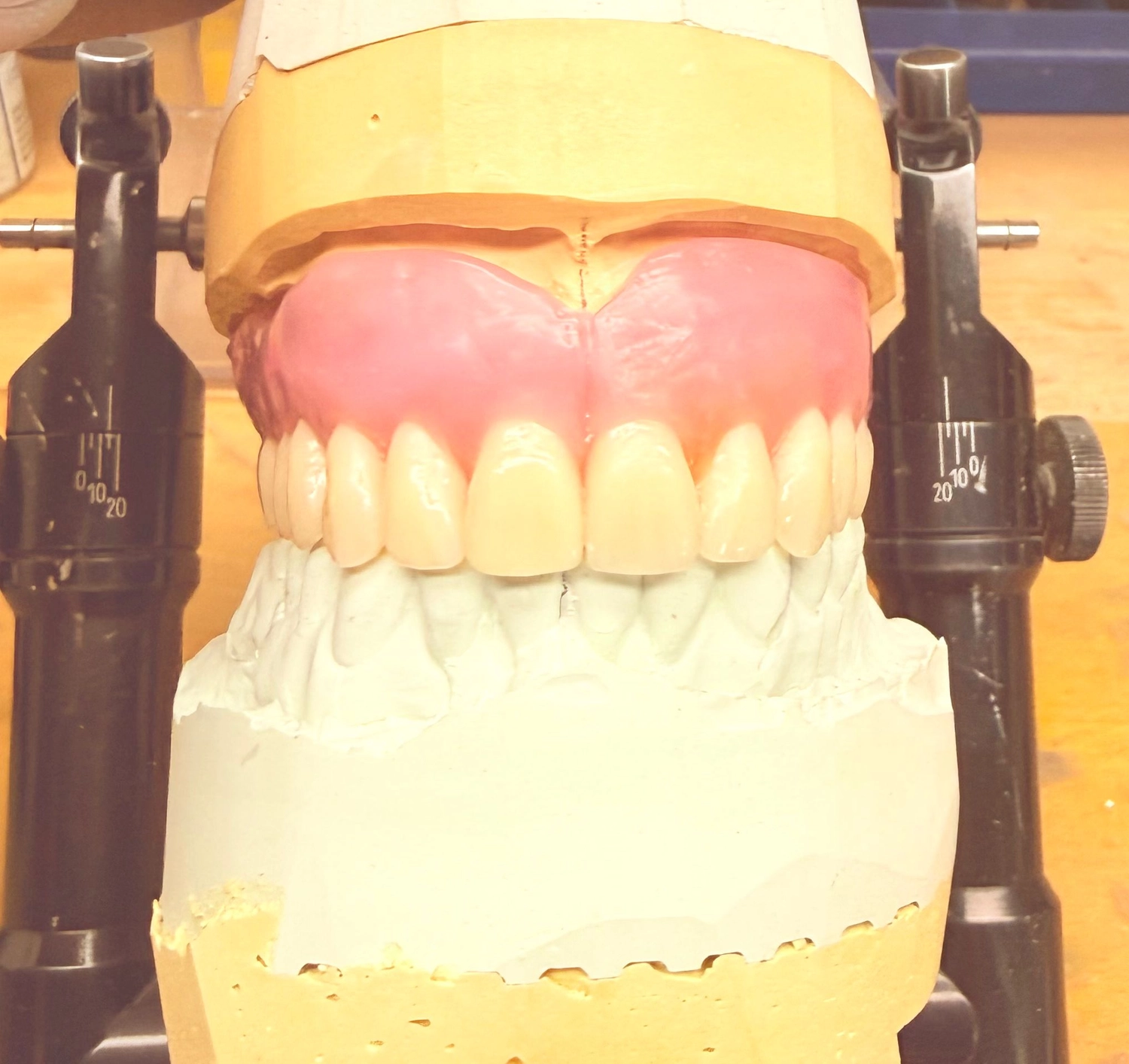 Kruse & Mordhorst Zahntechnik GmbH - Kronen & Brücken