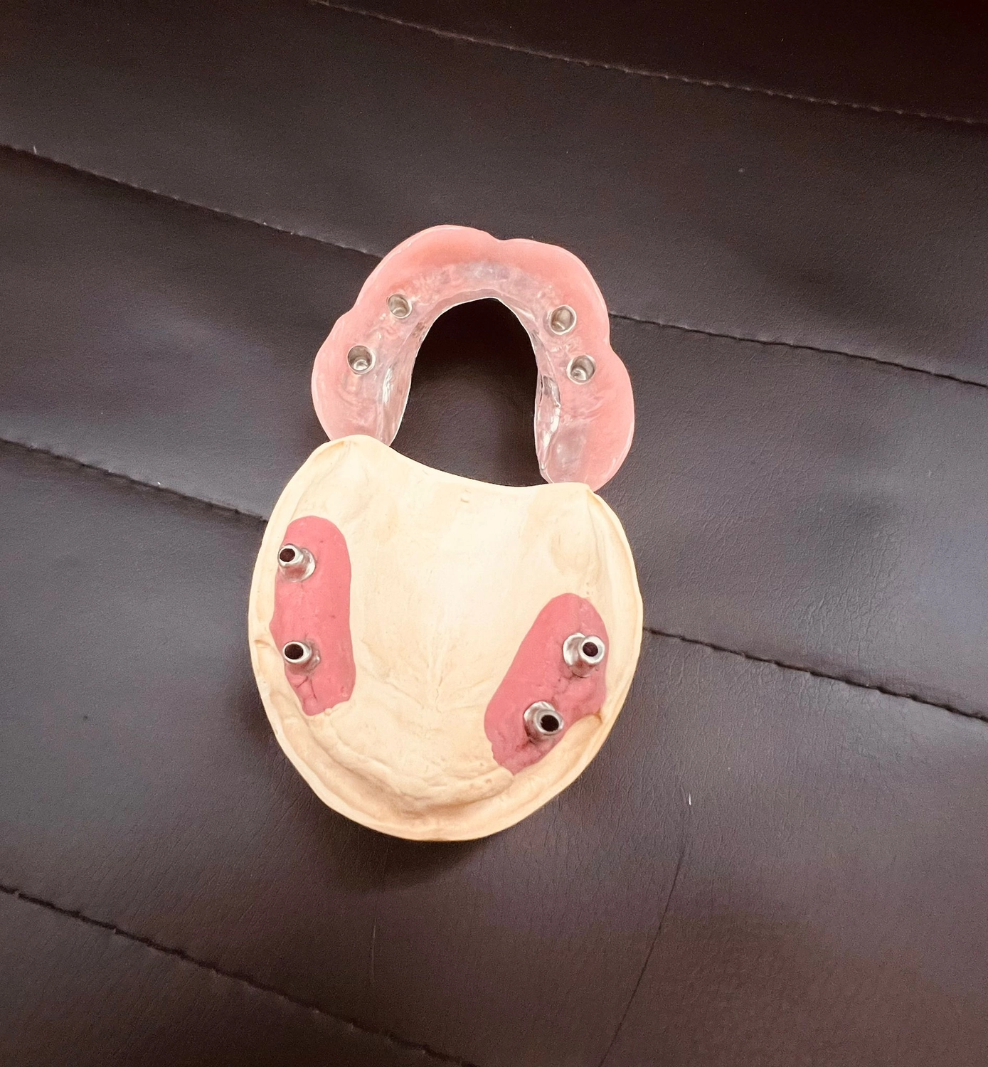 Kruse & Mordhorst Zahntechnik GmbH - Kronen & Brücken