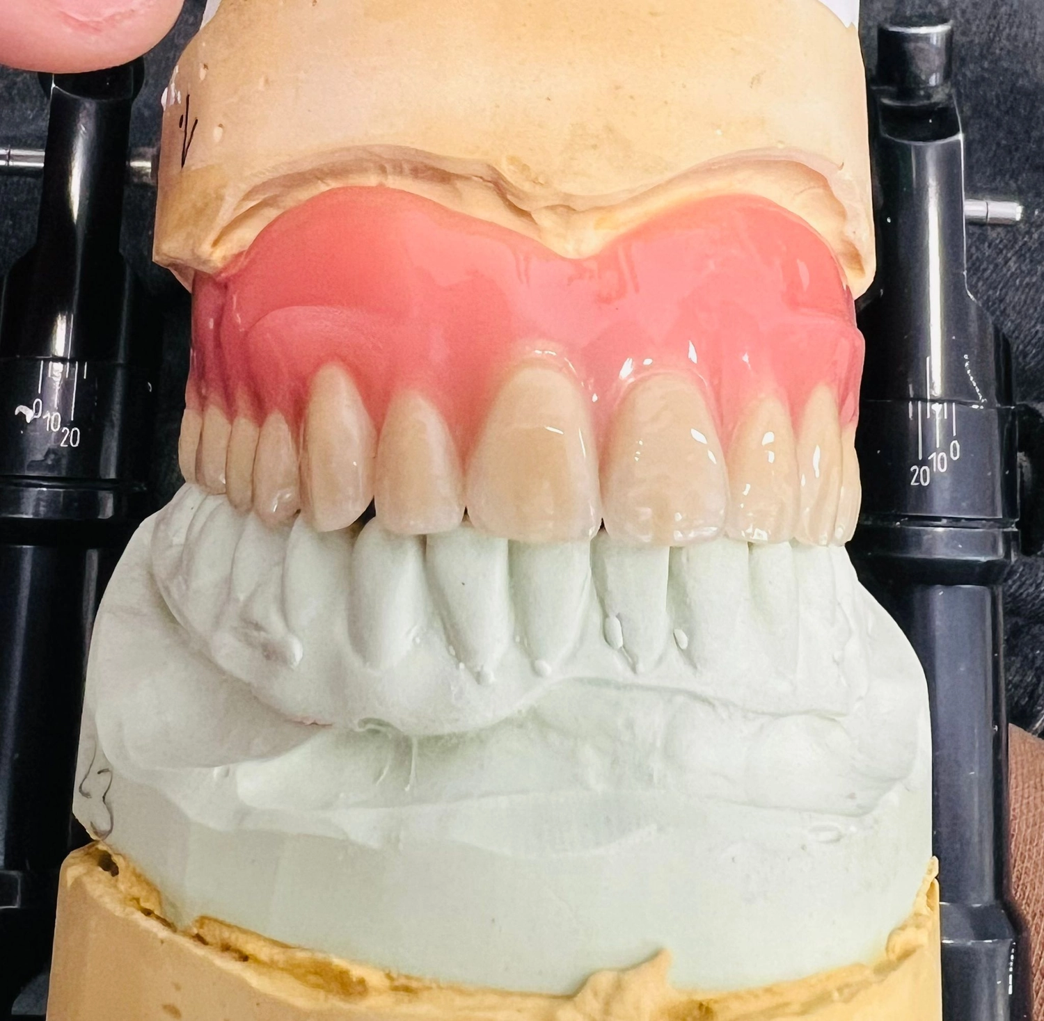 Kruse & Mordhorst Zahntechnik GmbH - Kronen & Brücken